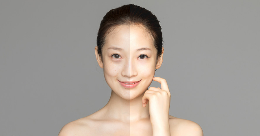 皮肤管理
